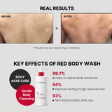 MEDICUBE | Red Acne Body Wash - 400 ml