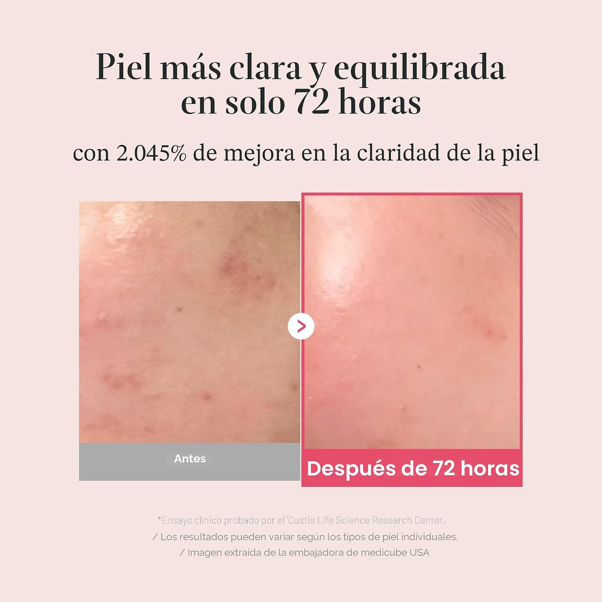 TXA Niacinamide 15 Serum - 30ml