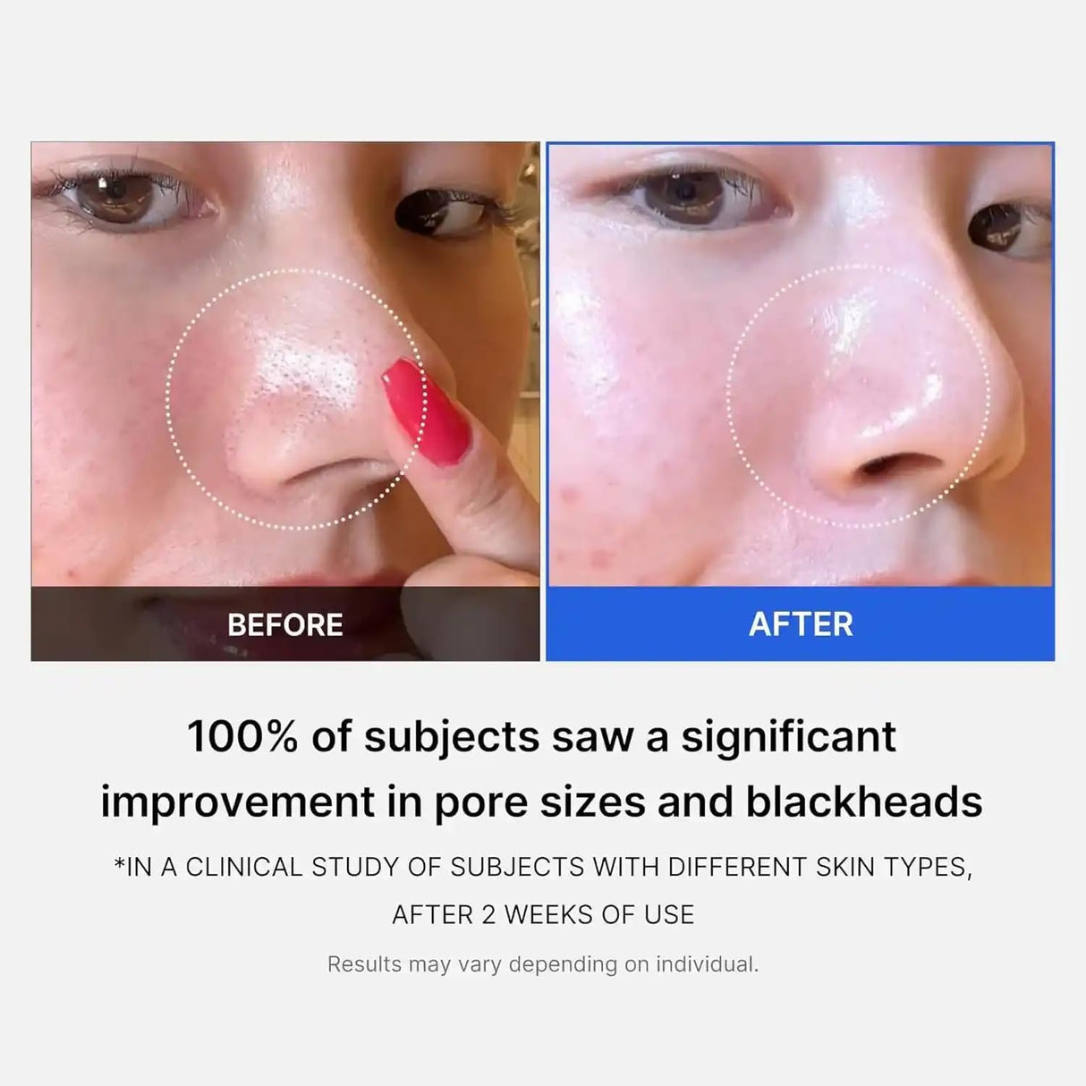 MEDICUBE | Zero Pore Pad 2.0 - 70 ud