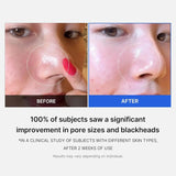 MEDICUBE | Zero Pore Pad 2.0 - 70 ud