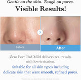 MEDICUBE | Zero Pore Pad Mild - 70ud