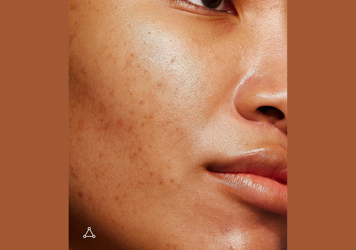 ALLIES OF SKIN | Formato de Viaje Mandelic Pigmentation Corrector Night Serum - 8ml - InternationalCosmetic