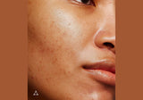 ALLIES OF SKIN | Formato de Viaje Mandelic Pigmentation Corrector Night Serum - 8ml - InternationalCosmetic