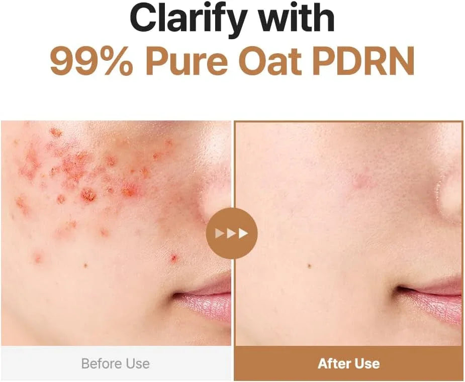 PURITO | Oat PDRN Gentle Refining Toner- 200ml - InternationalCosmetic
