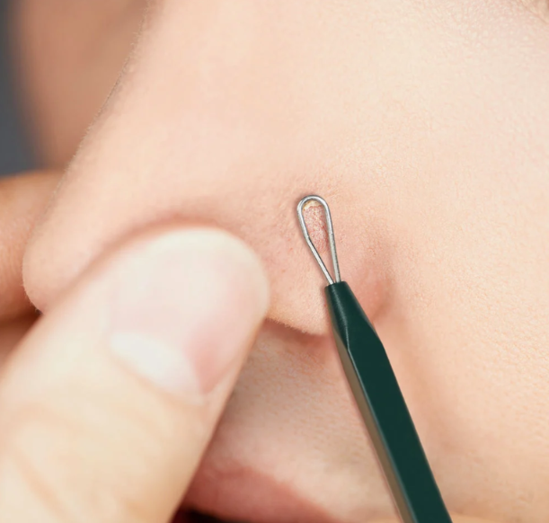 PYUNKANG YUL | Pimple Extractor