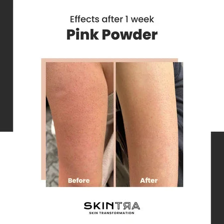 SKINTRA | - Pink Pow(d)er - 40ml - InternationalCosmetic