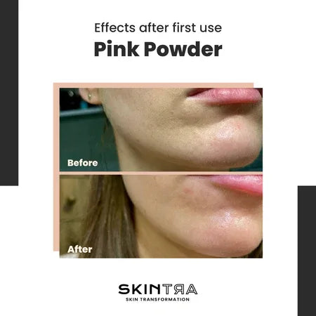 SKINTRA | - Pink Pow(d)er - 40ml - InternationalCosmetic