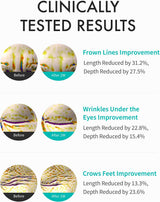 REJURAN | Intensive Eye Cream - 20ml