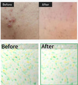 VT COSMETICS | Reti‑A Reedle Shot 700 - 30ml - InternationalCosmetic