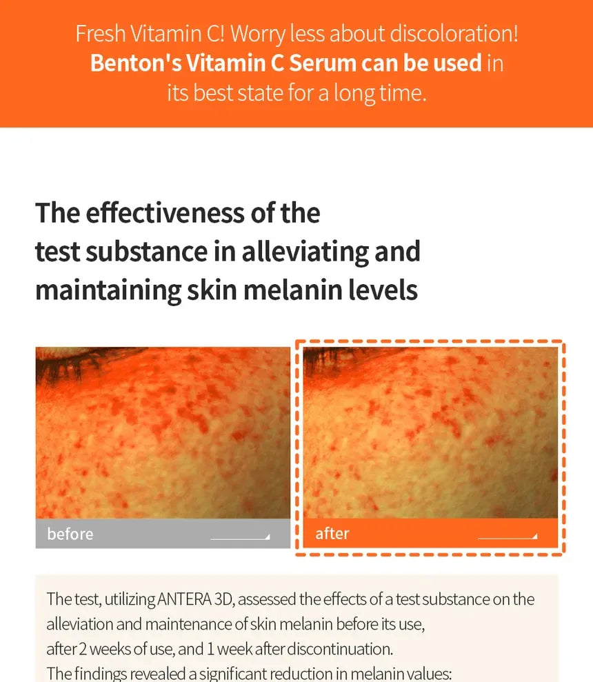 BENTON | Vitamin C Serum 20% - 30ml - InternationalCosmetic