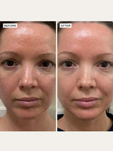 ALPHA-H | Vitamin B Serum - InternationalCosmetic