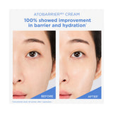 AESTURA Atobarrier 365 Cream Mini - 30ml: resultados cosméticos y evaluación de uso, comparativa adicional; hidratación y barrera cutánea