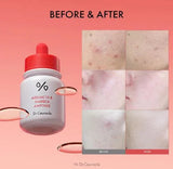 DR. CEURACLE | Azelaic 10 & Madeca Ampoule - 30ml - InternationalCosmetic
