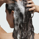 YOPE | Skinimally Dry Scalp Shampoo - 250ml - InternationalCosmetic