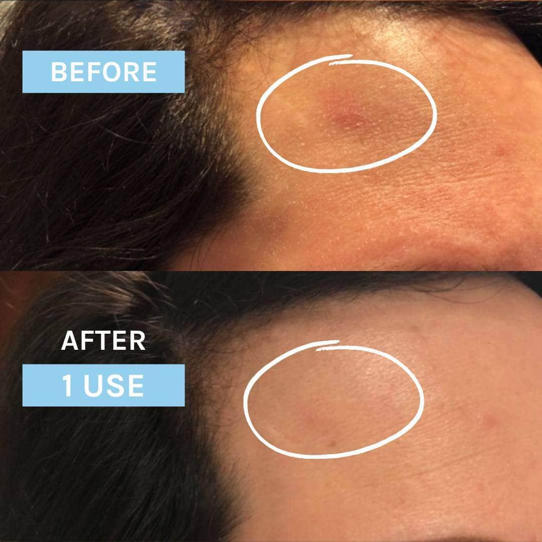EVOLVE | Blue Velvet Ceramide Serum - 30ml - InternationalCosmetic