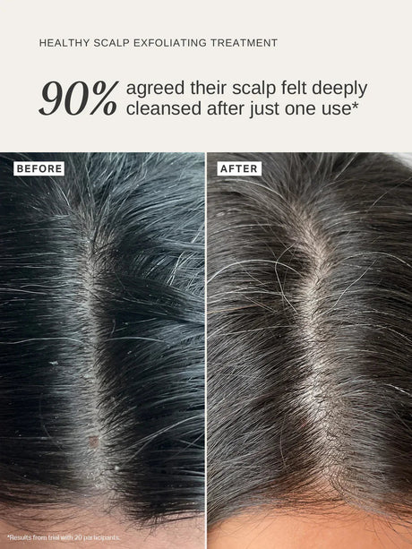 ALPHA-H | Healthy Scalp Exfoliating Treatment - 100ml - InternationalCosmetic
