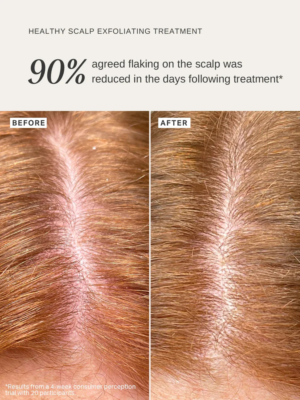 ALPHA-H | Healthy Scalp Exfoliating Treatment - 100ml - InternationalCosmetic