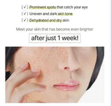 ANUA | Vitamin C Blemish Serum Mask - 1ud - InternationalCosmetic