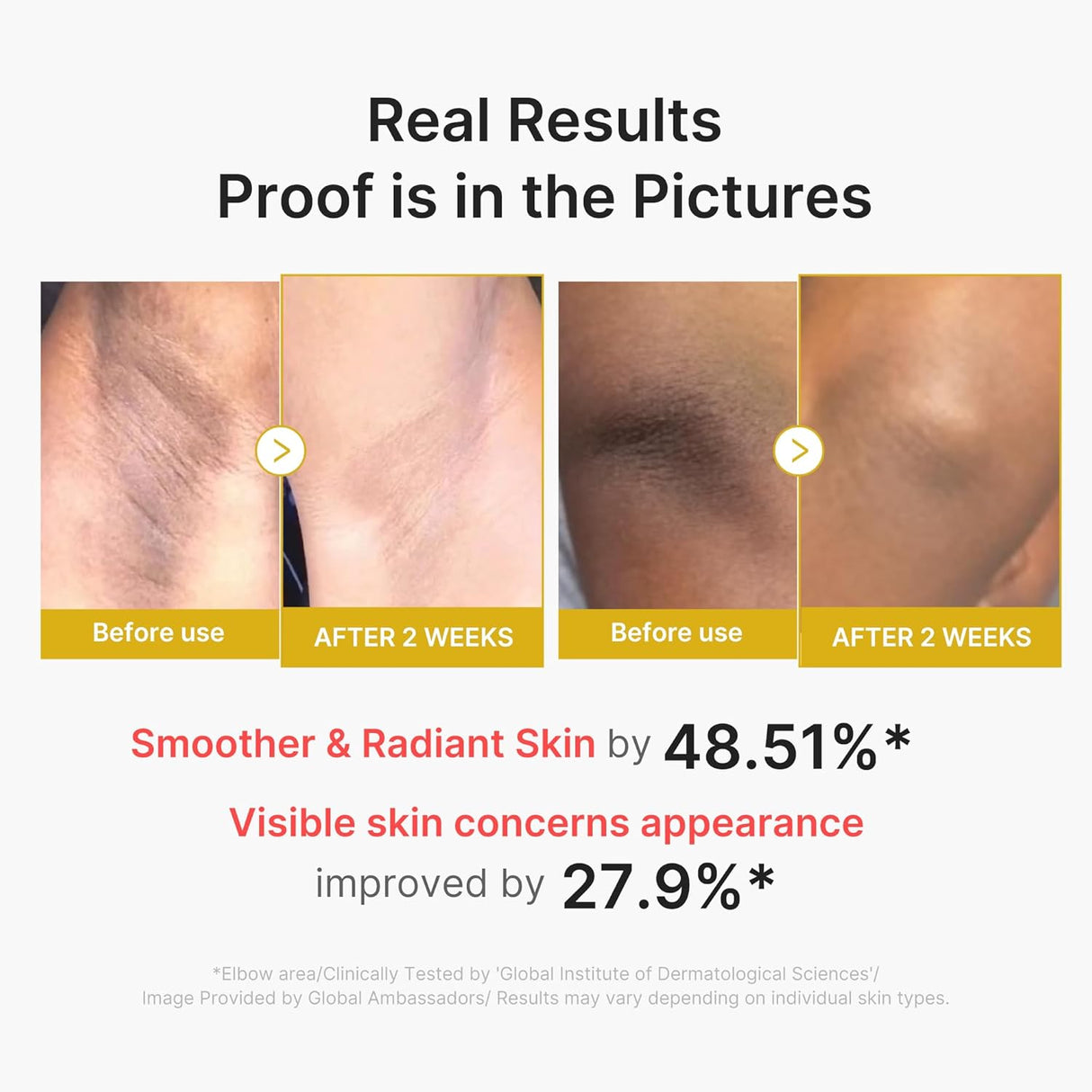 MEDICUBE | Kojic Acid Turmeric Body Peel Shot - 280ml