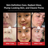 MEDICUBE | AGE - R Booster Pro - APEC Irworobongdo Edition