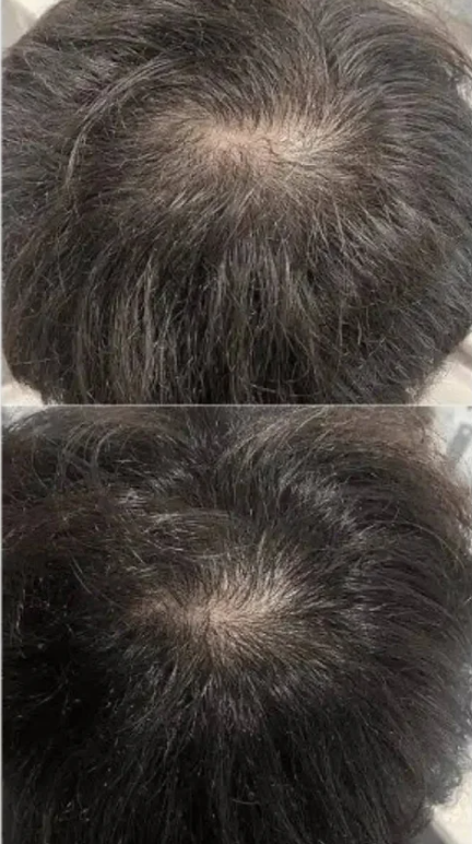 MEDICUBE | Soyxidil Shampoo - 490ml