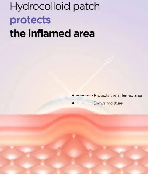 ISNTREE | Onion Newpair Spot Patch - InternationalCosmetic