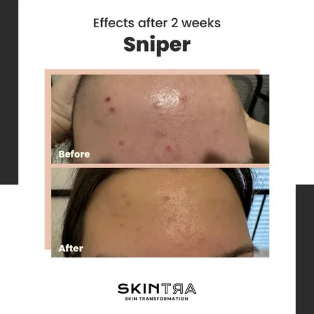 SKINTRA | Sniper Crema SOS - 20ml - InternationalCosmetic