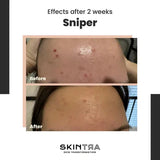 SKINTRA | Sniper Crema SOS - 20ml - InternationalCosmetic
