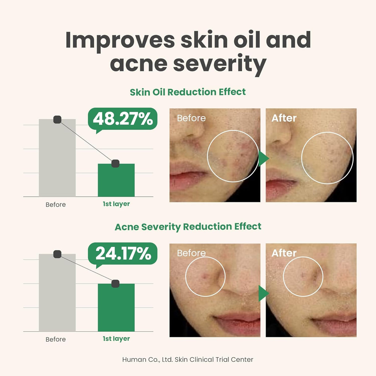 AXIS-Y | Spot The Difference Blemish Treatment - 15ml