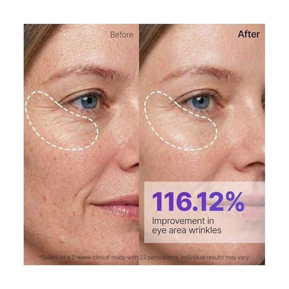 SUNGBOON EDITOR Silk Peptide EGF Intensive Gold Mask - 4Uds: resultados cosméticos y evaluación de uso; protección solar y cuidado de la piel