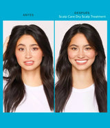 LIVING PROOF | Scalp Care Dry Treatment - 100ml - InternationalCosmetic