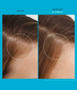 LIVING PROOF | Scalp Care Revitalizing Treatment - 73ml - InternationalCosmetic