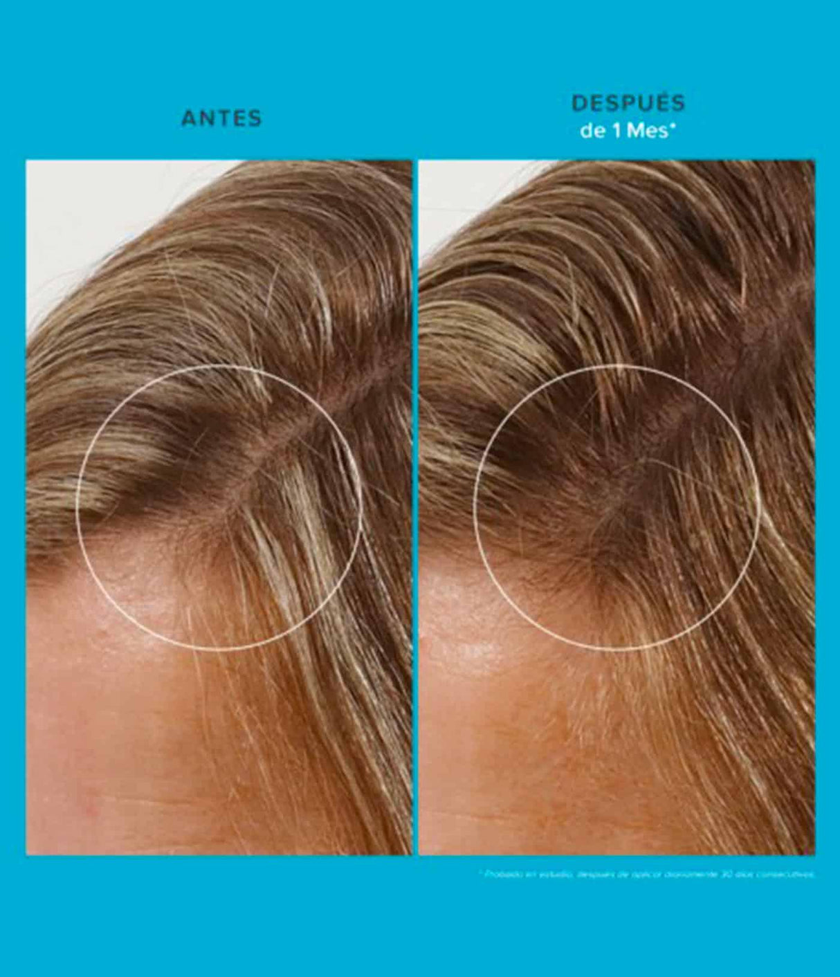 LIVING PROOF | Scalp Care Revitalizing Treatment - 73ml - InternationalCosmetic